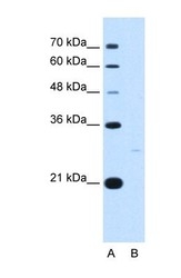 NBP1-56651 - 14-3-3 protein zeta/delta
